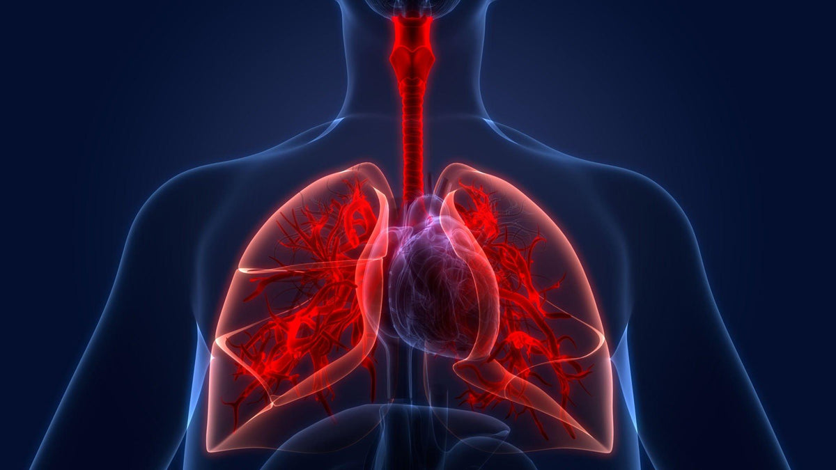 Sarcoidosis